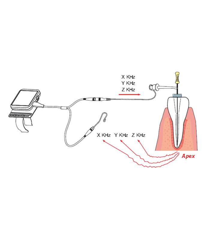 NAVIROOT - MINI RILEVATORE APICALE ELETTRONICO